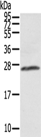 Rabbit Polyclonal Antibody to AQP1