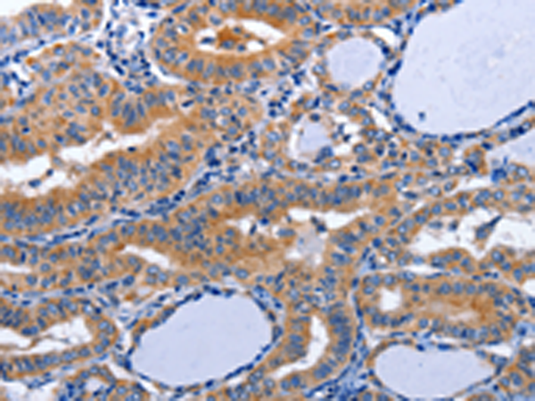 Rabbit Polyclonal Antibody to AQP8