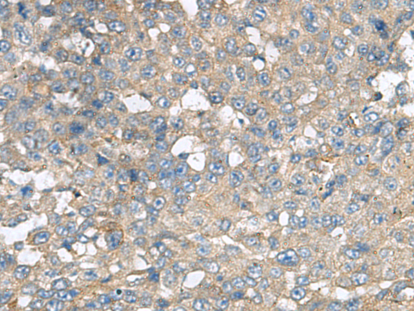 Rabbit Polyclonal Antibody to CXCR5
