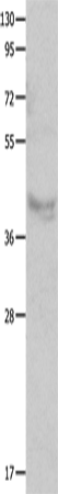 Rabbit Polyclonal Antibody to CX3CR1