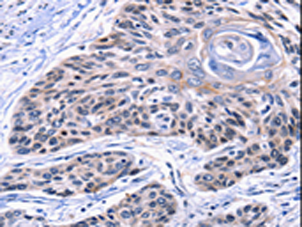 Rabbit Polyclonal Antibody to CCNB2