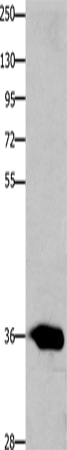 Rabbit Polyclonal Antibody to CCND2