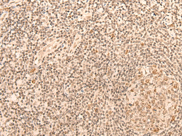 Rabbit Polyclonal Antibody to CCNE1