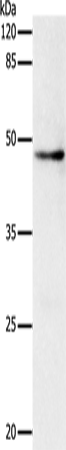 Rabbit Polyclonal Antibody to DRD1