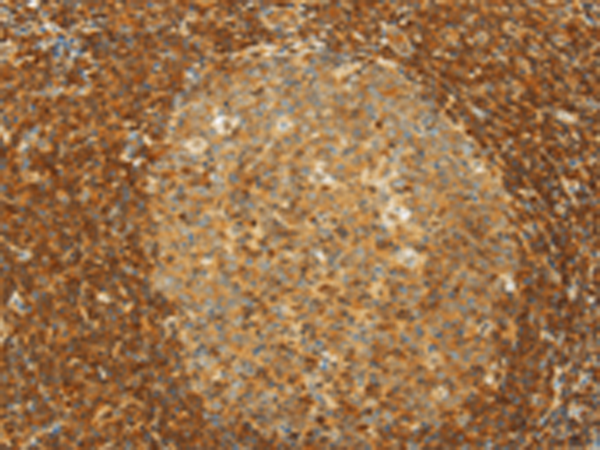 Rabbit Polyclonal Antibody to SLC6A3