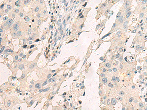 Rabbit Polyclonal Antibody to LY75