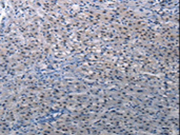 Rabbit Polyclonal Antibody to DEFA1