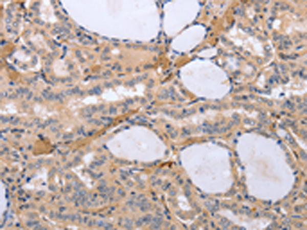 Rabbit Polyclonal Antibody to TYROBP