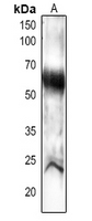 Rabbit Polyclonal Antibody to PEX14