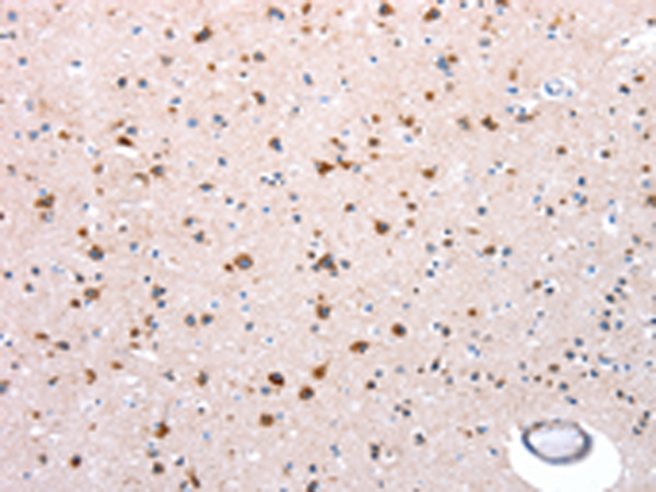 Rabbit Polyclonal Antibody to NDUFA12