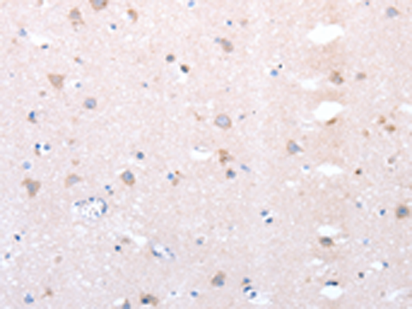 Rabbit Polyclonal Antibody to DTX1