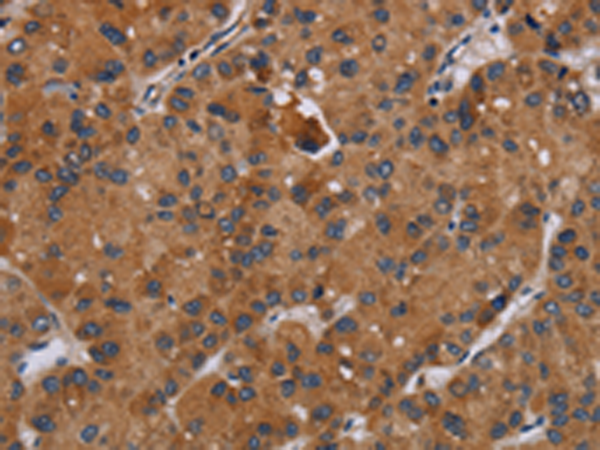Rabbit Polyclonal Antibody to DISC1