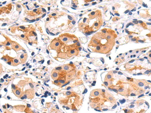 Rabbit Polyclonal Antibody to DMBT1