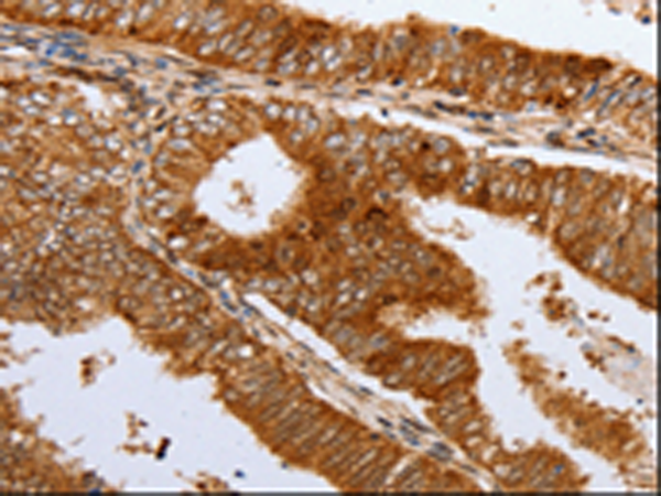 Rabbit Polyclonal Antibody to DNMT1