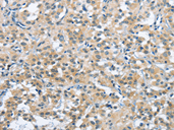 Rabbit Polyclonal Antibody to TRDMT1