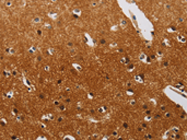 Rabbit Polyclonal Antibody to DTNBP1