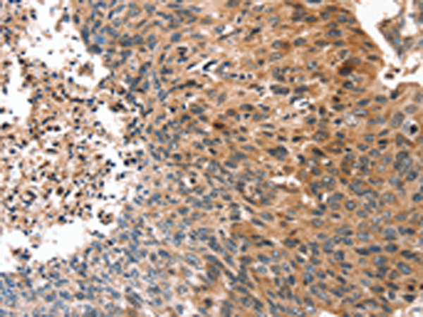 Rabbit Polyclonal Antibody to DUT