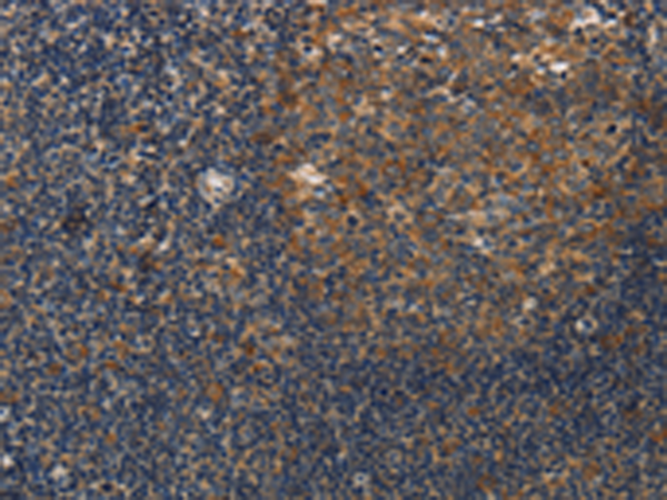 Rabbit Polyclonal Antibody to DSP