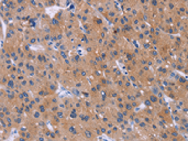 Rabbit Polyclonal Antibody to DVL2