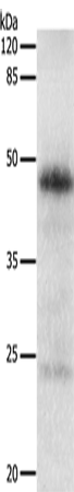 Rabbit Polyclonal Antibody to EDA