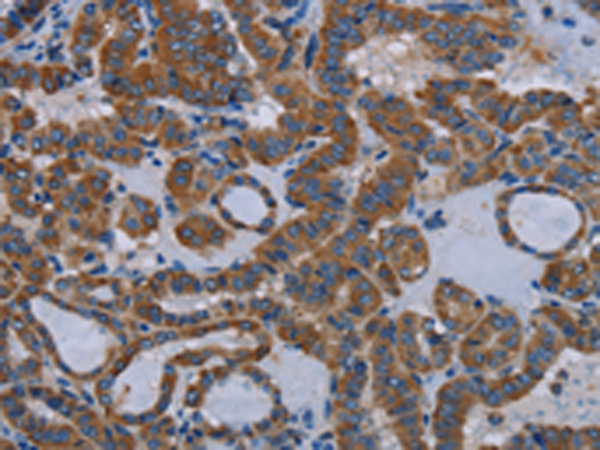 Rabbit Polyclonal Antibody to EDNRB