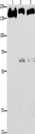 Rabbit Polyclonal Antibody to EGFR