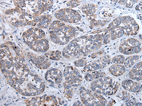 Rabbit Polyclonal Antibody to SFRP5