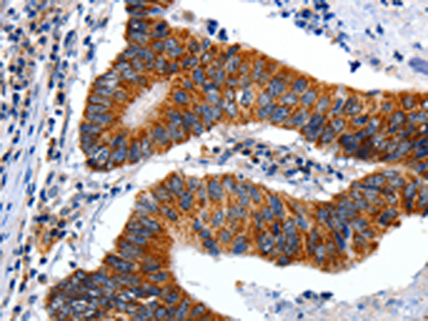 Rabbit Polyclonal Antibody to ENPP3