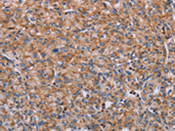 Rabbit Polyclonal Antibody to ENPP7