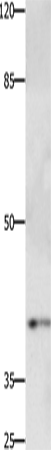 Rabbit Polyclonal Antibody to PTGER1
