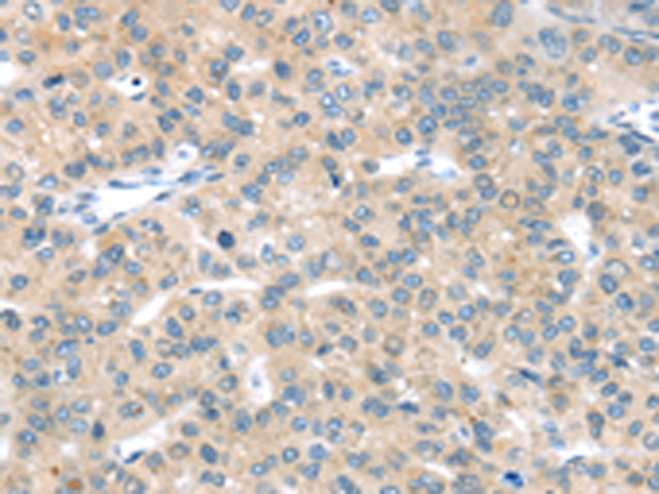 Rabbit Polyclonal Antibody to EPHA2