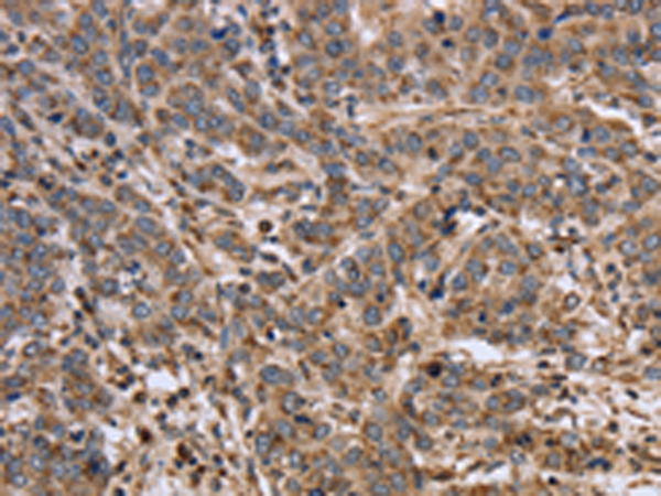 Rabbit Polyclonal Antibody to EPOR