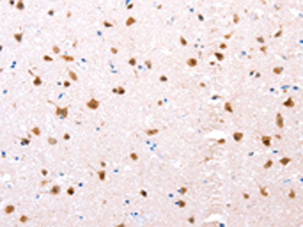 Rabbit Polyclonal Antibody to ESR1