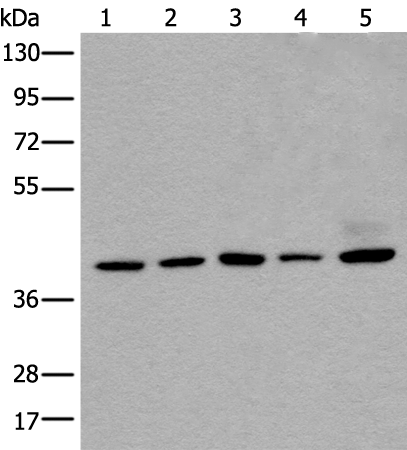 Rabbit Polyclonal Antibody to ESR2