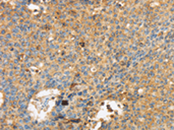 Rabbit Polyclonal Antibody to MAPK6