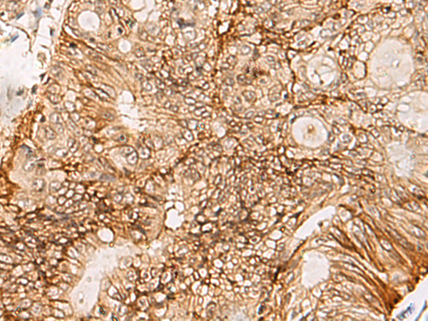 Rabbit Polyclonal Antibody to EPCAM
