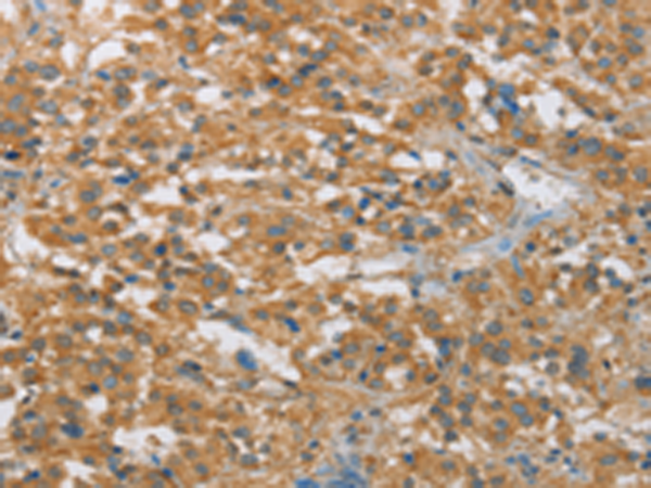 Rabbit Polyclonal Antibody to FASLG