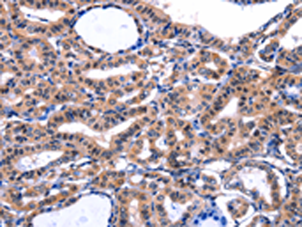 Rabbit Polyclonal Antibody to FBN1