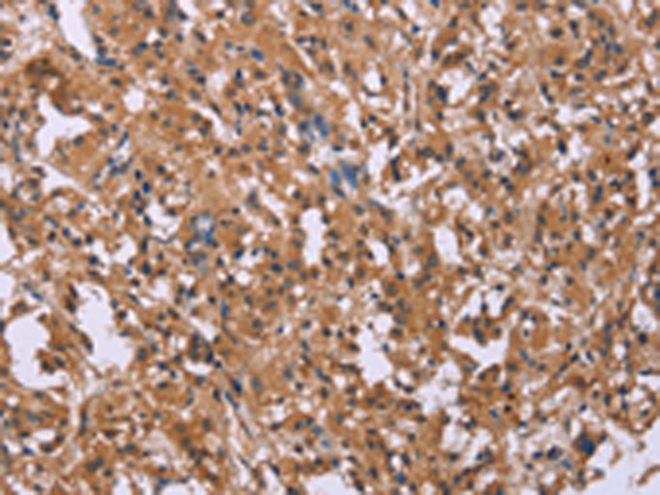 Rabbit Polyclonal Antibody to FGFR2