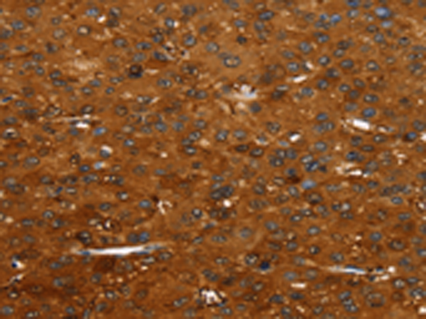 Rabbit Polyclonal Antibody to FGFR3