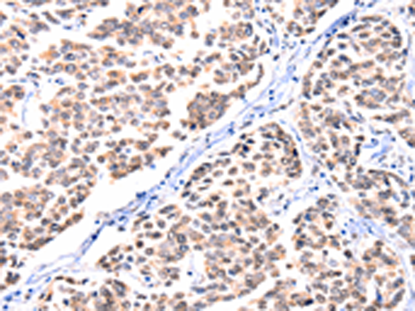 Rabbit Polyclonal Antibody to FBLN1
