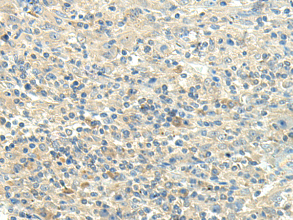 Rabbit Polyclonal Antibody to FBLN5