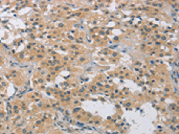 Rabbit Polyclonal Antibody to FOSB
