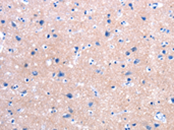Rabbit Polyclonal Antibody to FPR2