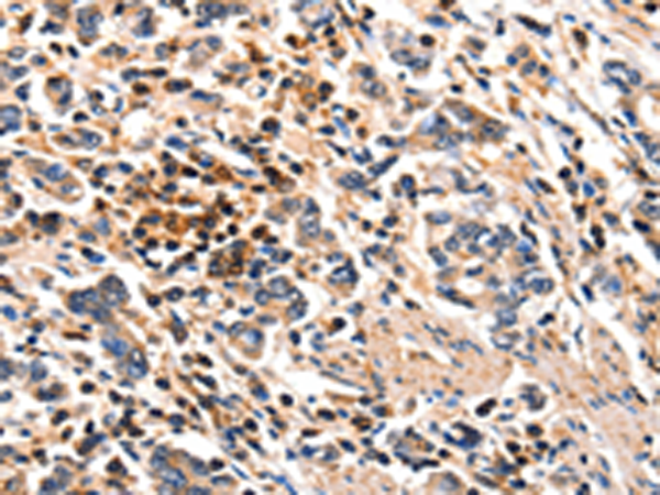 Rabbit Polyclonal Antibody to FOXB2