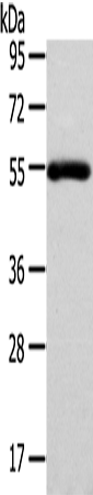 Rabbit Polyclonal Antibody to FOXC1