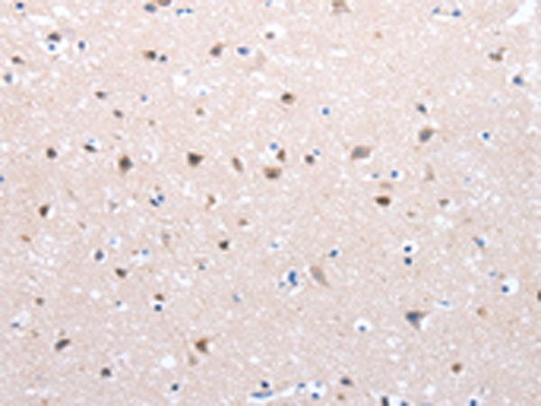 Rabbit Polyclonal Antibody to FOXD2