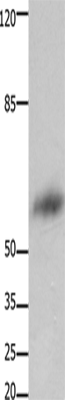 Rabbit Polyclonal Antibody to FOXJ3