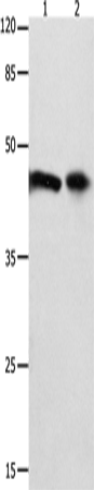 Rabbit Polyclonal Antibody to FOXL1
