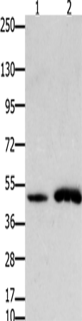 Rabbit Polyclonal Antibody to FOXL2